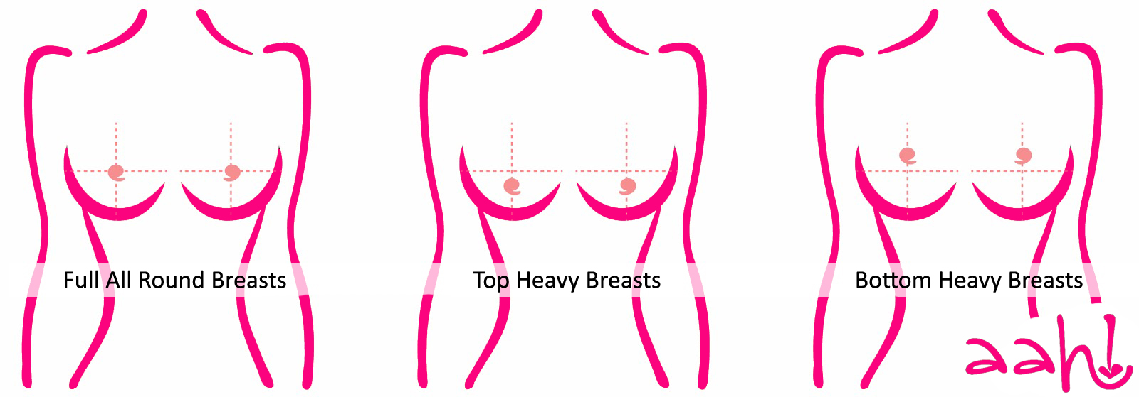 Breast Density